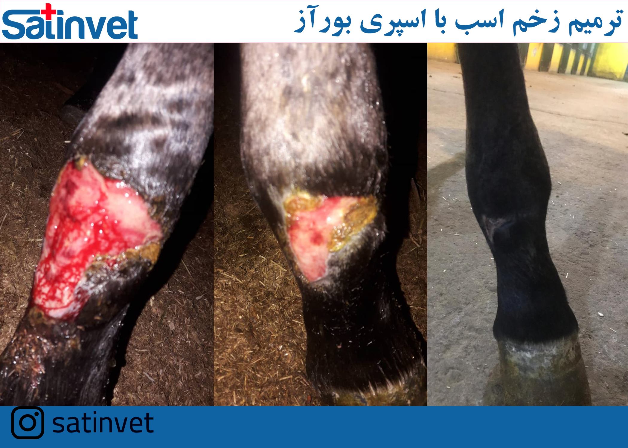 قبل و بعد